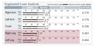 Segmental Lean Analysis is used to check muscle mass in hospitalized patients.