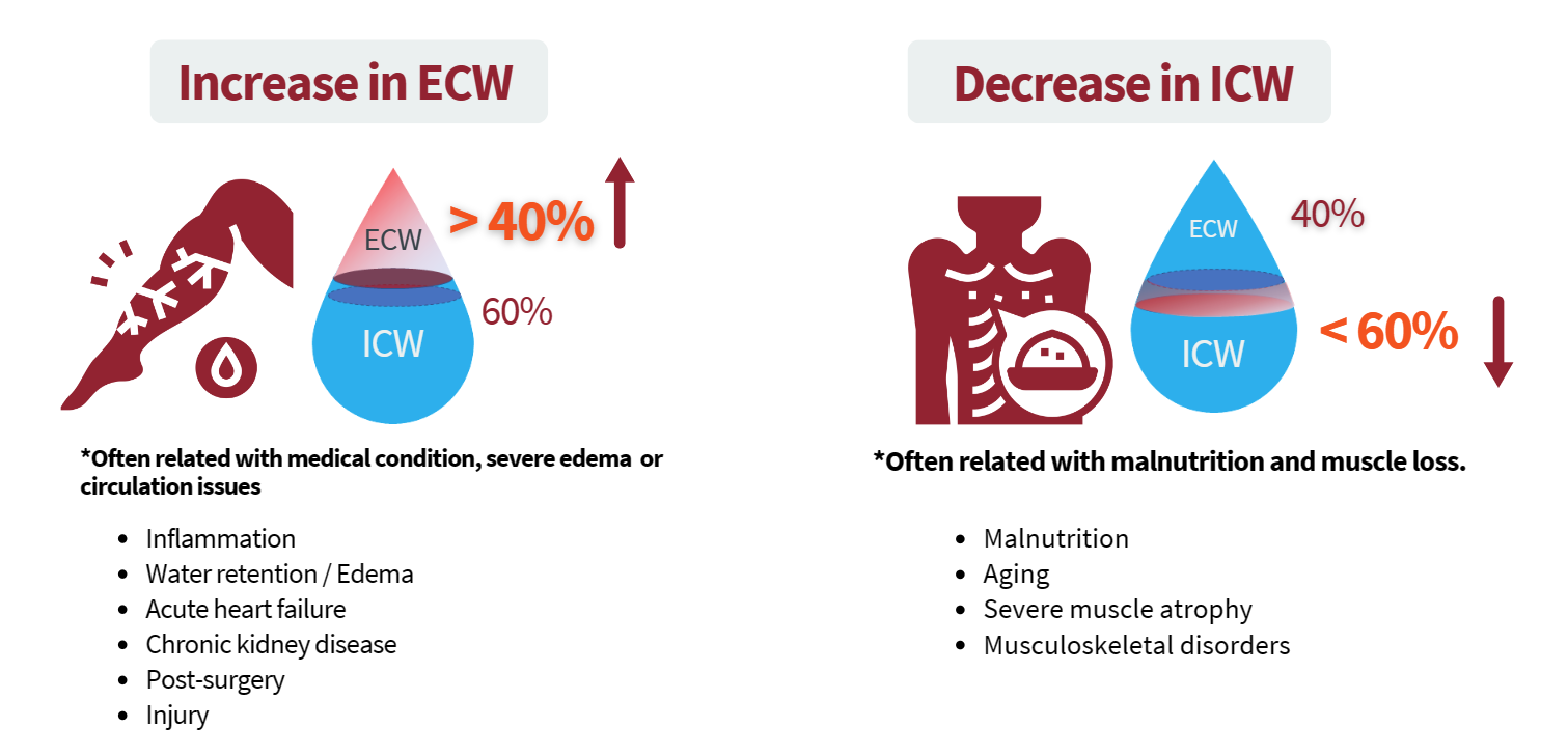 Causes of high ECW Ratio