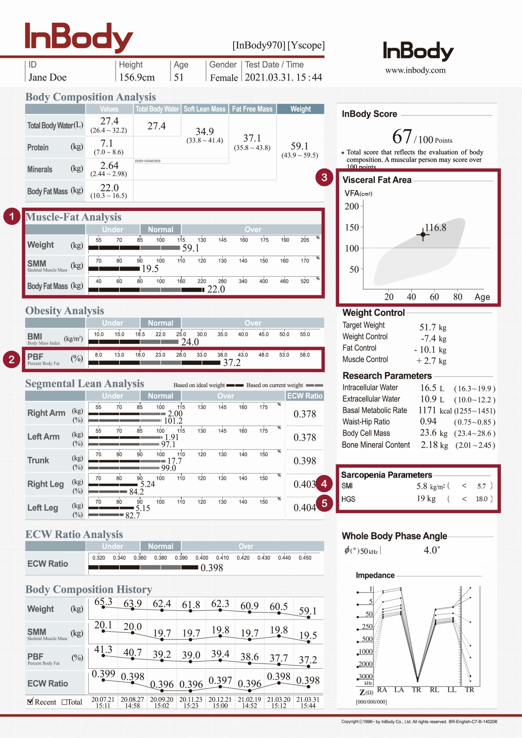 InBody in Screening Sarcopenic Obesity