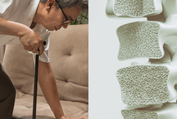 Sarcopenia & Osteoporosis